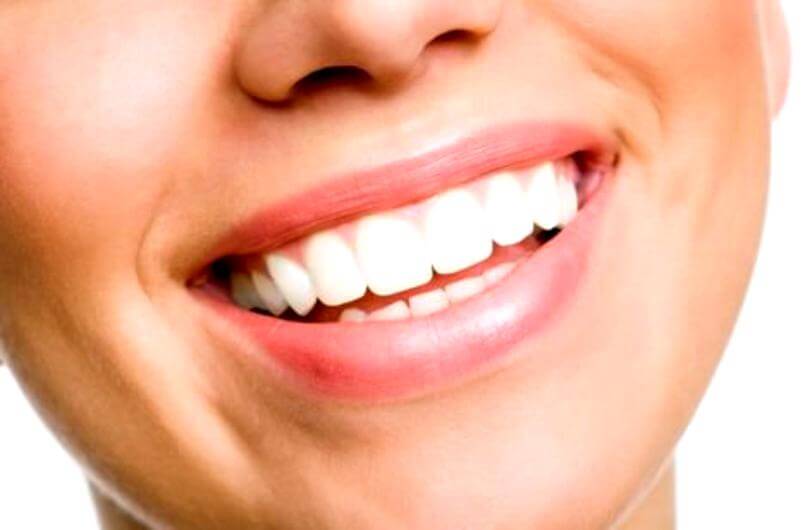 Care sunt avantajele implanturilor dentare?